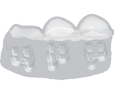 maestro3d | Dental Studio | Ortho Studio | Clear Aligner | Brackets Tray