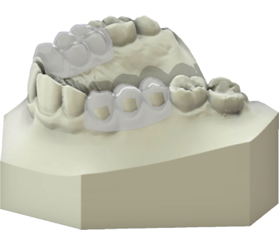 maestro3d | Dental Studio | Ortho Studio | Clear Aligner | Brackets Tray with windows