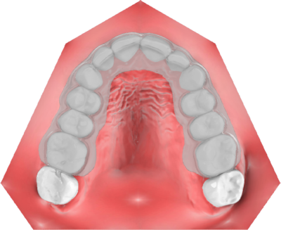 maestro3d | Dental Studio | Ortho Studio | Clear Aligner