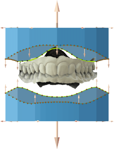 maestro3d | Dental Studio | Ortho Studio | Study Models