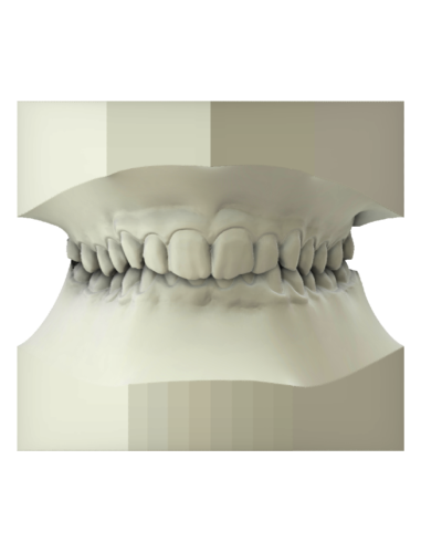 maestro3d | Dental Studio | Ortho Studio | Study Models