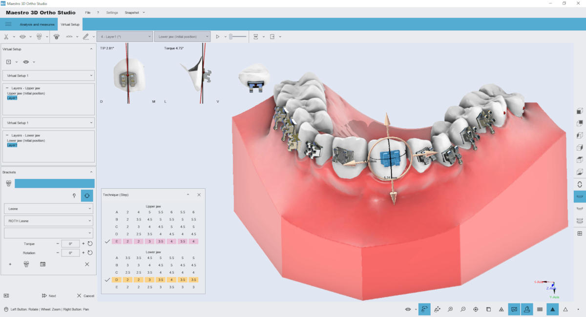 maestro3d | Dental Studio | Ortho Studio | Brackets Placement