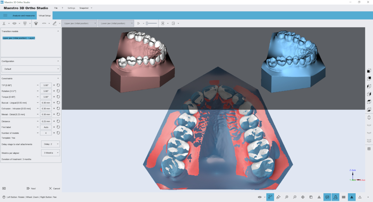 maestro3d | Dental Studio | Ortho Studio | Models Builder module